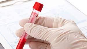 آغاز بزرگترین آزمایش جهانی “تست خون برای تشخیص ۵۰ نوع سرطان”