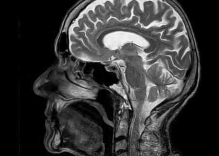 کشف جدید دانشمندان؛ چرا مغز انسان تا این حد بزرگ است؟