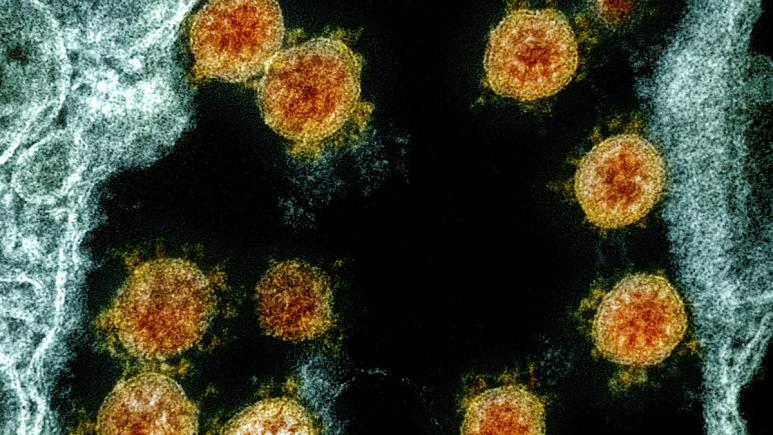 تحقیقات جدید: نوع غالب ویروس کنونی کرونا مسری‌تر از نوع اولیه آن در چین است