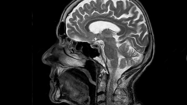 کشف جدید دانشمندان؛ چرا مغز انسان تا این حد بزرگ است؟